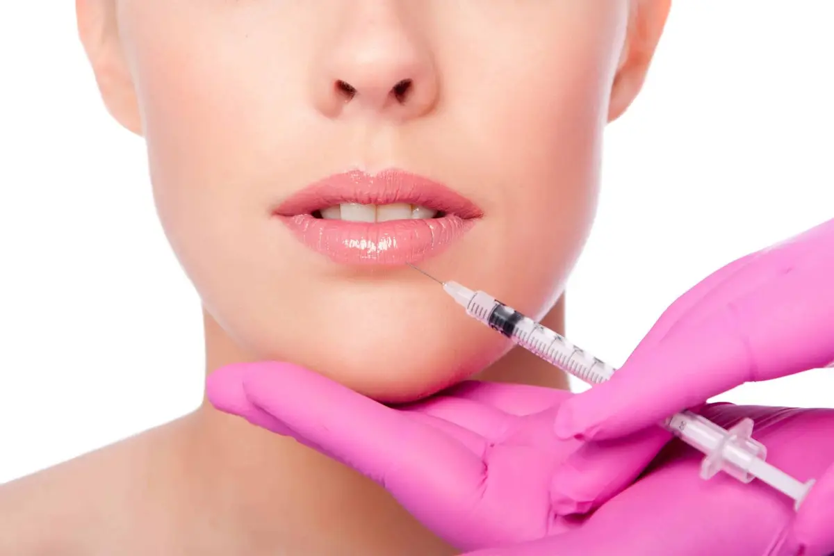 Beauty lip collagen filler injection