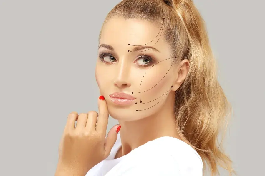 endolift explained