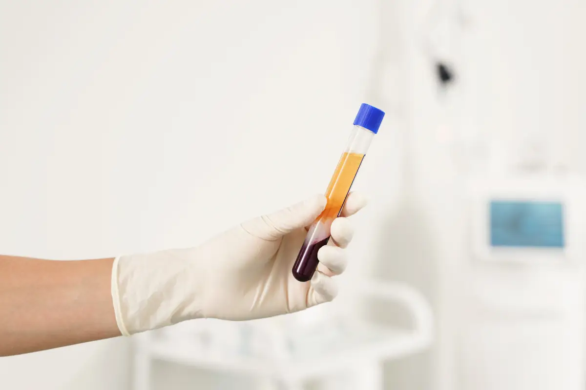 Exosomes vs. PRP