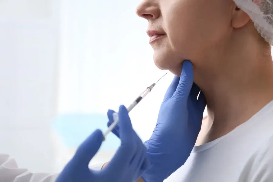 facial fat accumulation 