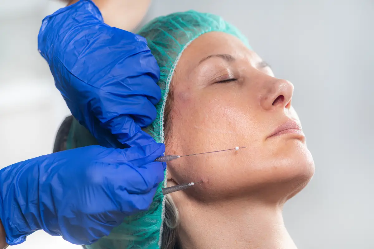 Facial Lifting