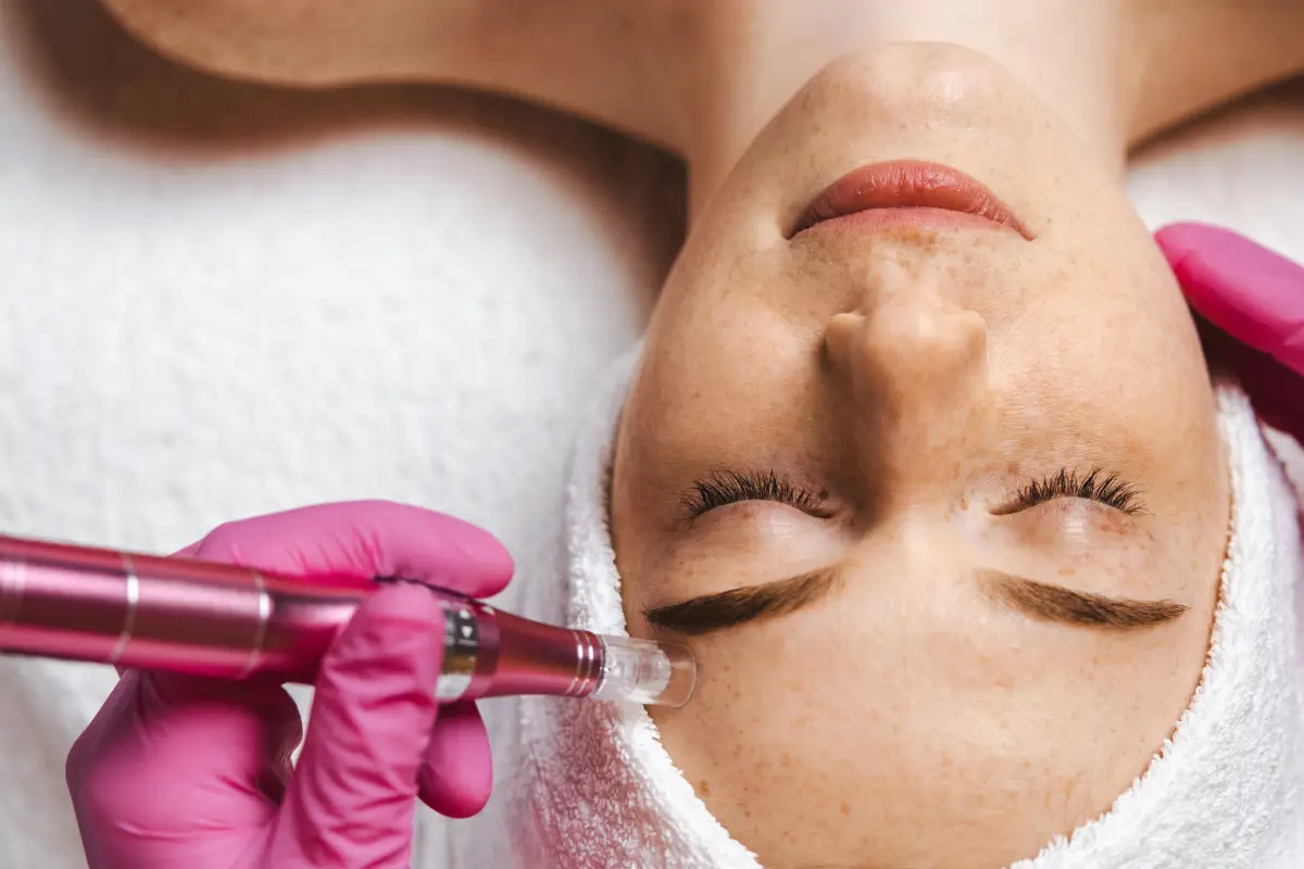 Morpheus8 vs. RF Microneedling: Which Activates Collagen Better?