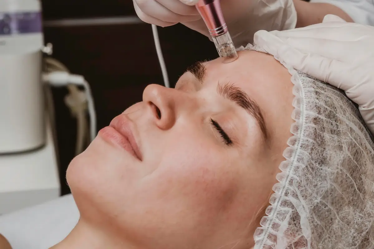 Morpheus8 vs. Traditional Microneedling