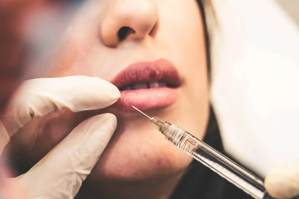 Woman is receiving lip dermal fillers in Glasgow.